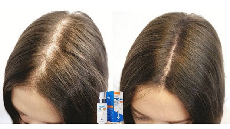 Jakie są efekty stosowania Trichomist Forte?, tricho mist forte